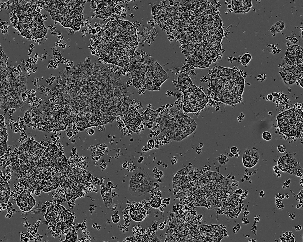 C125PM Colorectal Cell Line. 7 d post plating. Image courtesy of the European Collection of Authenticated Cell Cultures (ECACC)