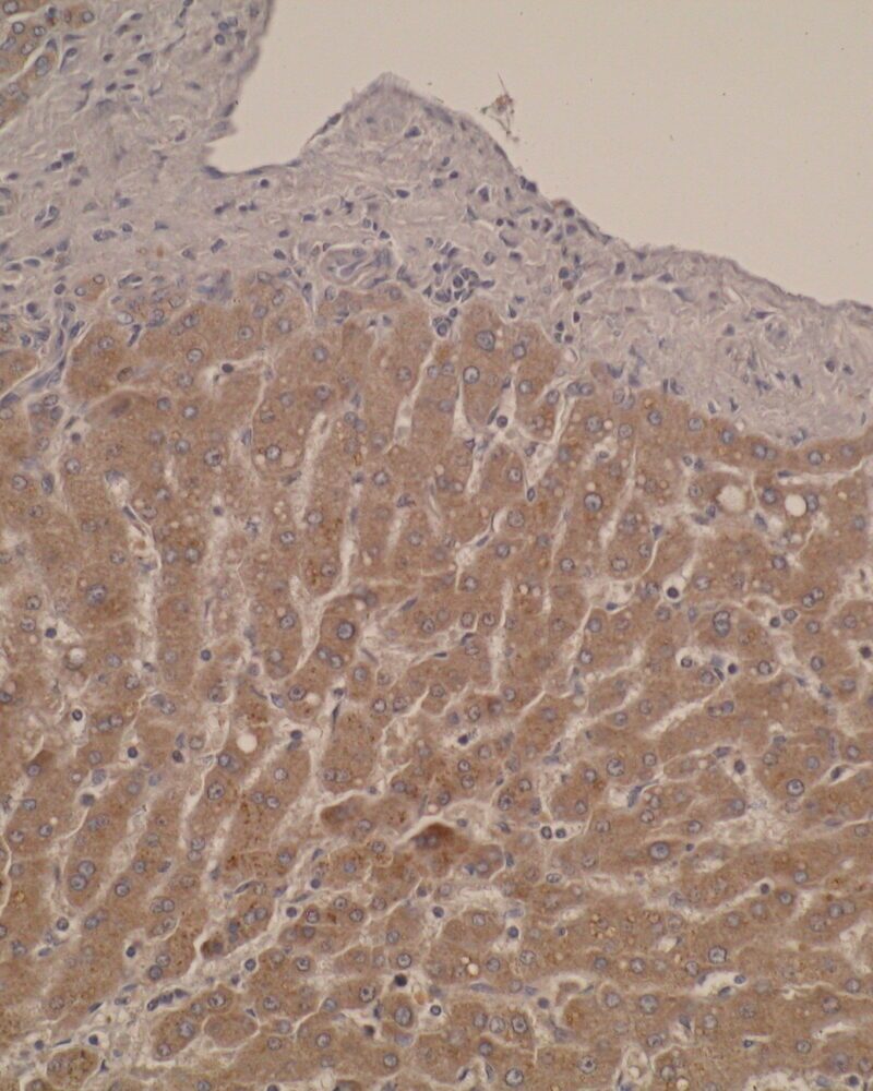 CYP26C1 normal liver