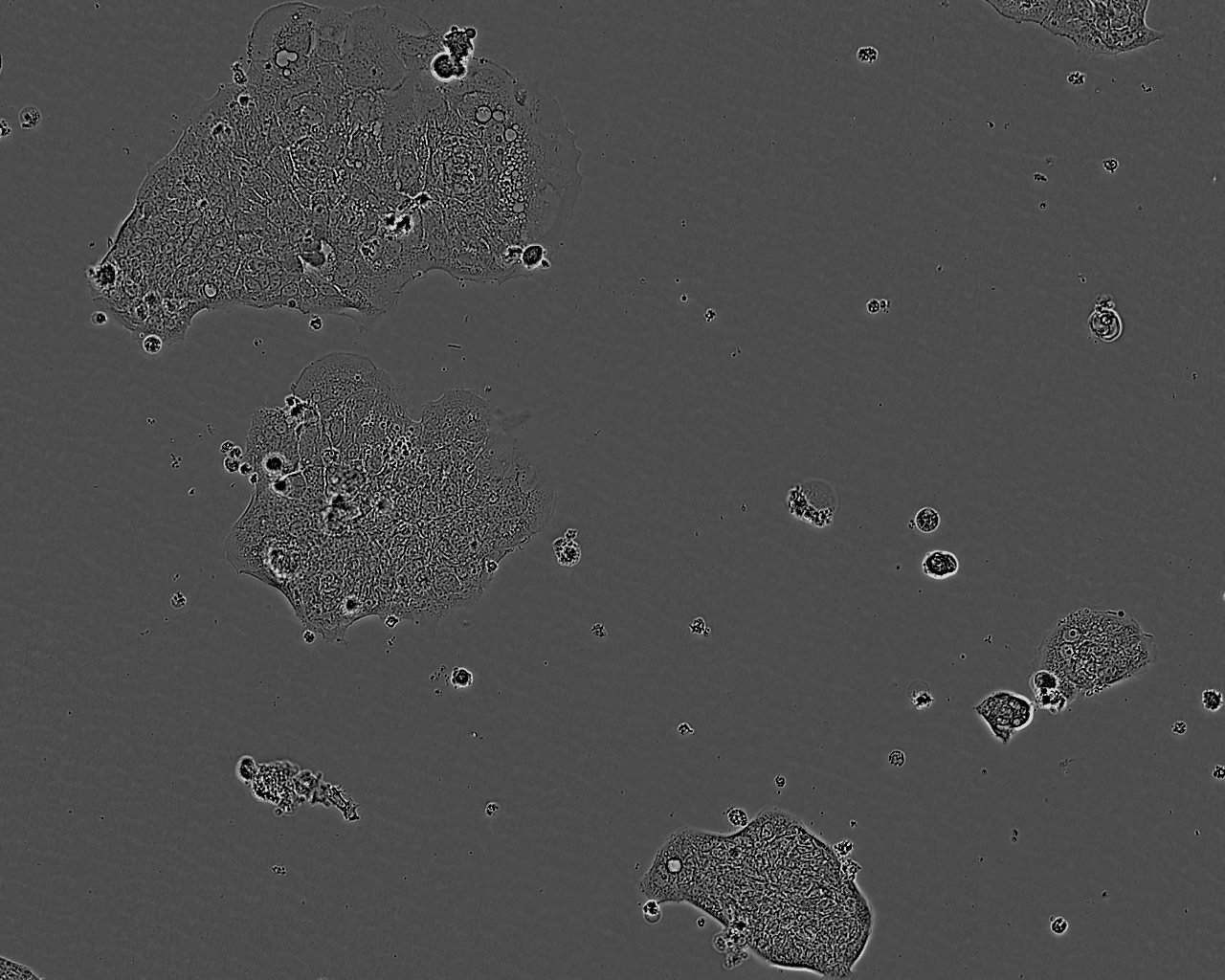 C70 Colorectal adenocarcinoma Cell Line. 7 days post plating. Image courtesy of the European Collection of Authenticated Cell Cultures (ECACC).
