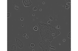 C10 Colorectal Cell Line. 7 days post plating. mage courtesy of the European Collection of Authenticated Cell Cultures (ECACC).