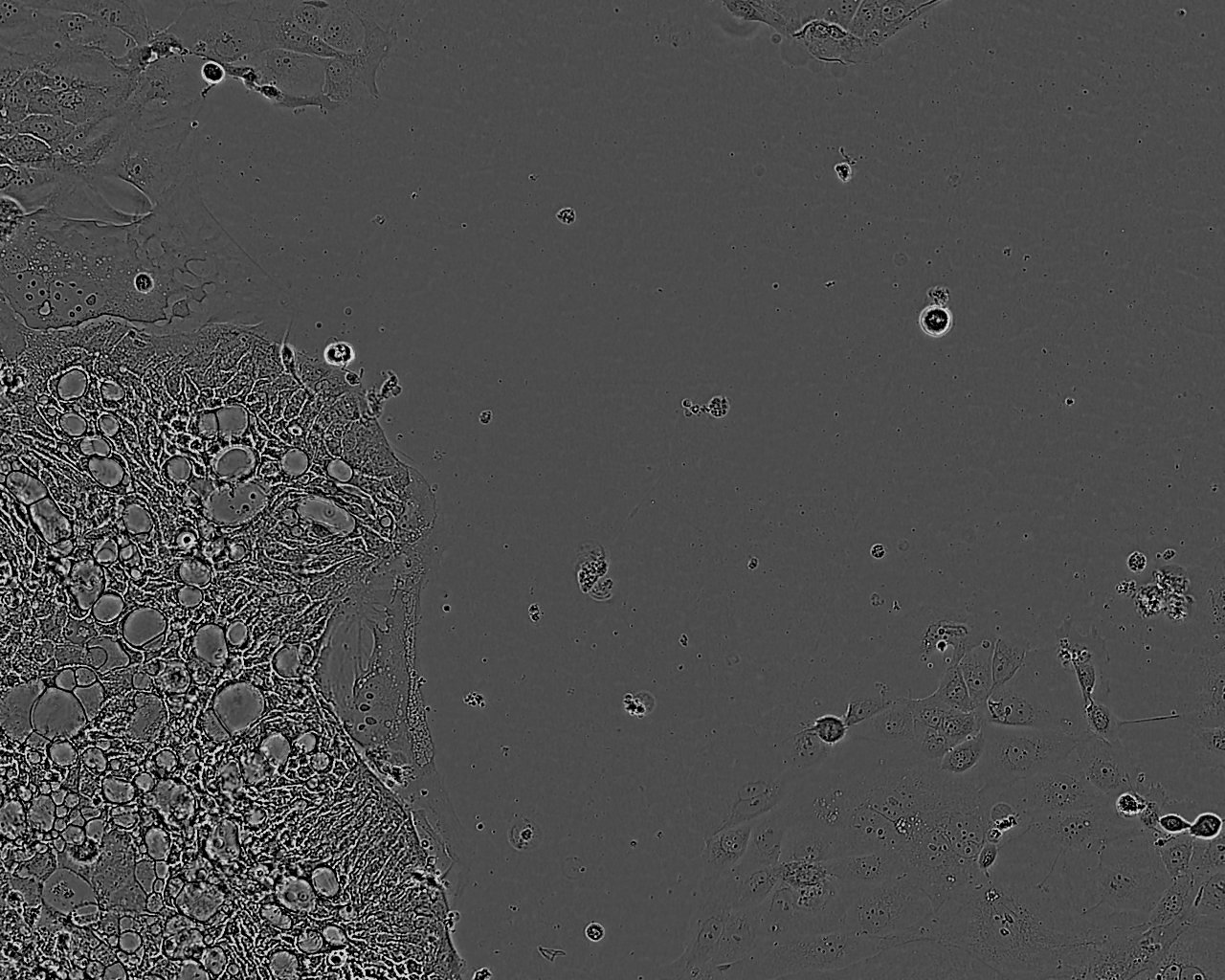 C32 Colorectal adenocarcinoma Cell Line. 6 days post plating. Image courtesy of the European Collection of Authenticated Cell Cultures (ECACC).