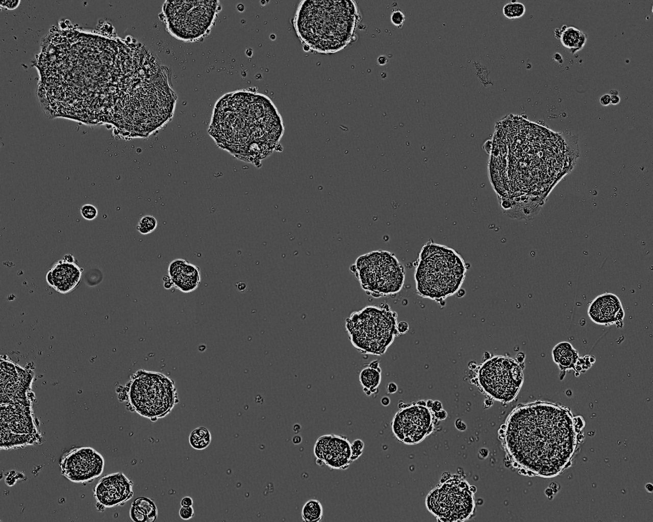 C75 Colorectal adenocarcinoma Cell Line. 96 days post plating. Image courtesy of the European Collection of Authenticated Cell Cultures (ECACC)