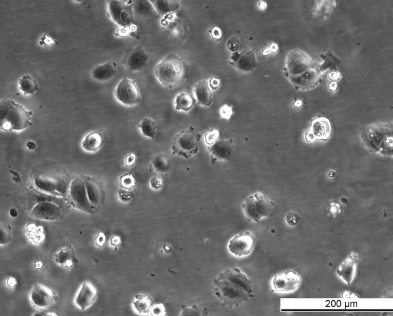 MCF7 164R-4 Cell Line. Early log phase. Image courtesy of the European Collection of Authenticated Cell Cultures (ECACC), UK.