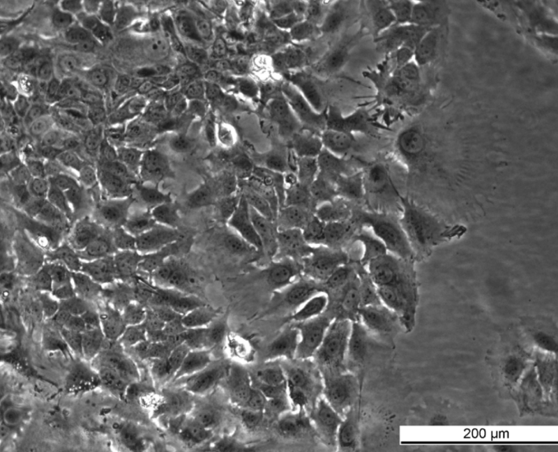 MCF7 164R-4 Cell Line. Late log phase. Image courtesy of the European Collection of Authenticated Cell Cultures (ECACC), UK.