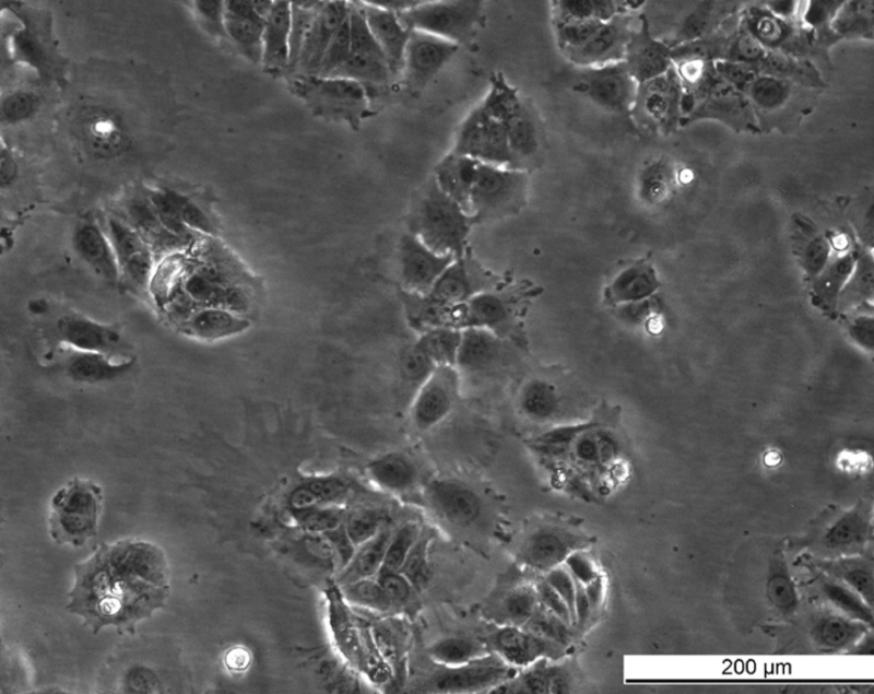 MCF7 164R-4 Cell Line. Mid log phase. Image courtesy of the European Collection of Authenticated Cell Cultures (ECACC), UK.
