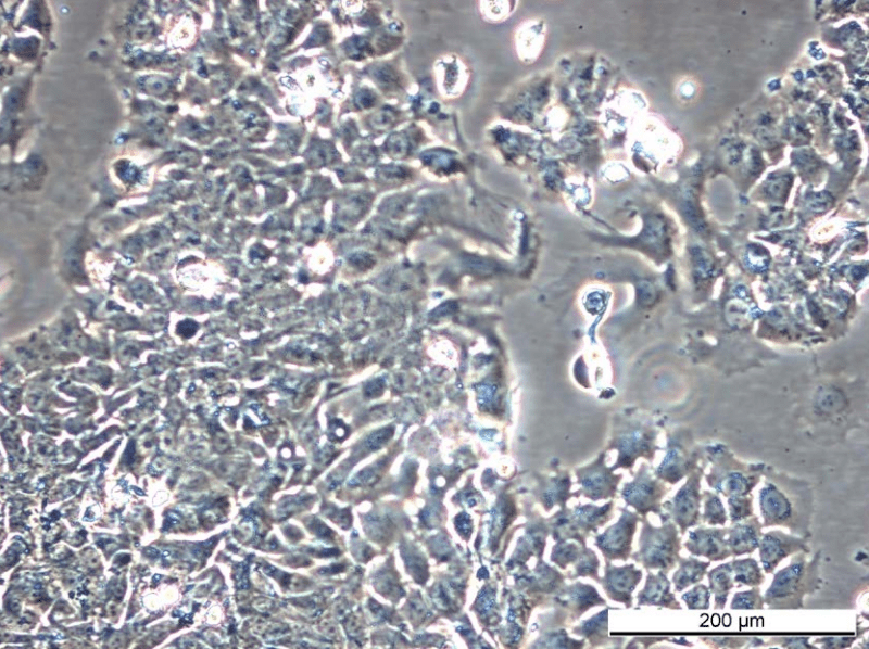 MCF7/164R-7 Cell Line - Image 3