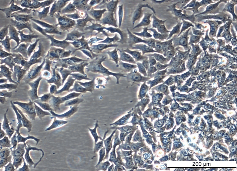 MCF7 AnaR-3 Cell Line. Mid log phase. Image courtesy of the European Collection of Authenticated Cell Cultures (ECACC), UK.