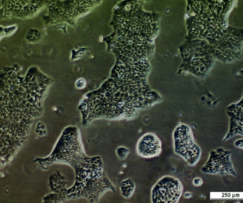 UM-UC-14 Cell Line. Image courtesy of the European Collection of Authenticated Cell Cultures (ECACC), UK.