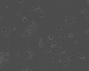 C106 Colorectal Cell Line. 3 days post plating. Image courtesy of the European Collection of Authenticated Cell Cultures (ECACC)