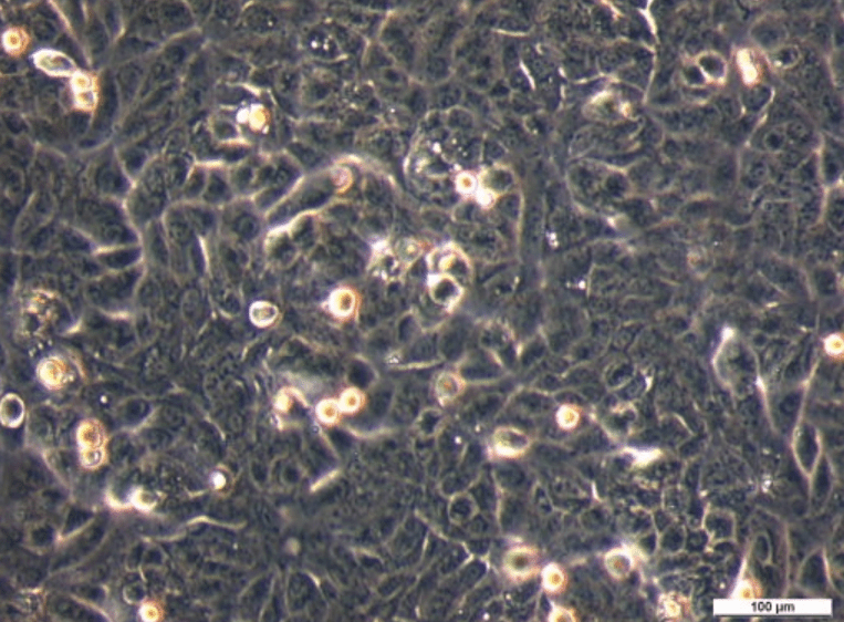 UM-UC-9 Cell Line. Image courtesy of the European Collection of Authenticated Cell Cultures (ECACC), UK.
