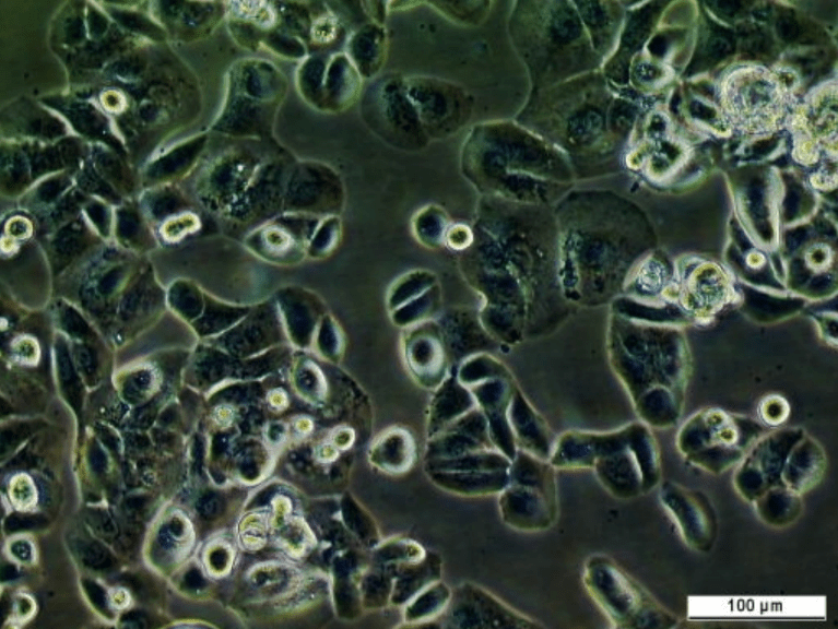 UM-UC-9 Cell Line. Image courtesy of the European Collection of Authenticated Cell Cultures (ECACC), UK.