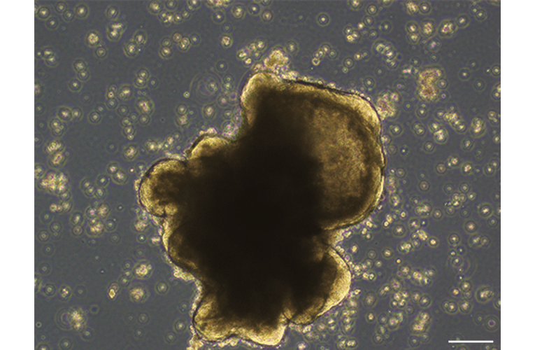RCOL003-3 Colorectal cancer organoid